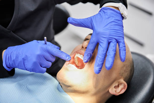 Best Emergency Tooth Extraction in Lisbon, ND